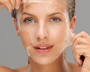 Peeling químico